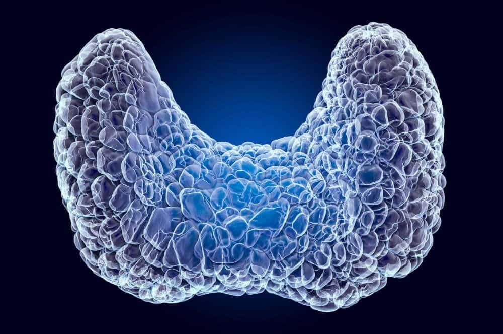 multinodular goiter
