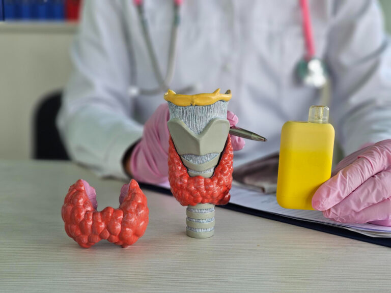 علاج الغدة الدرقية النشطة باليود المشع: خطوات العلاج، النتائج، وأهم النصائح