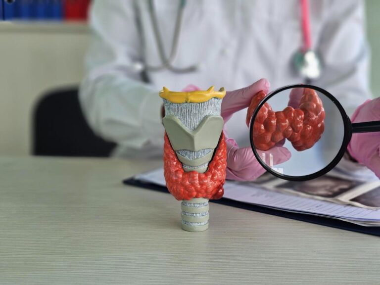 Multinodular Goiter: Causes, Symptoms & Modern Treatments