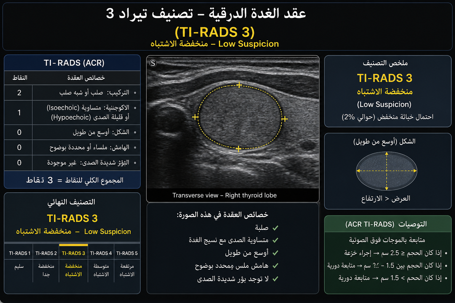 عقد الغدة الدرقية تيراد 3